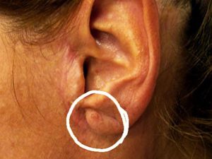 raisin-ear