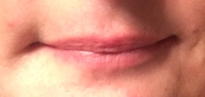 Before Luscious Lips