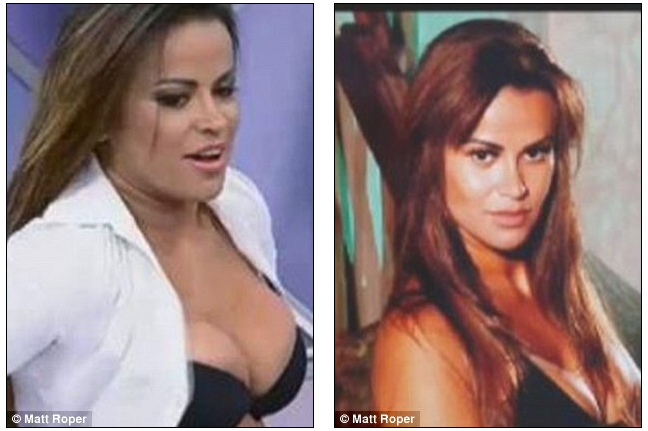 plastic surgery plastic surgery