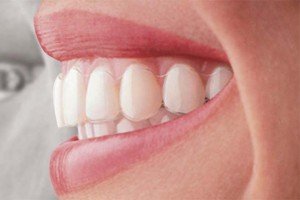 Beautiful Smile, Lips Enhanced